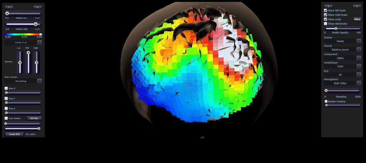 Prikaz moždane aktivnosti u neurofeedback programu